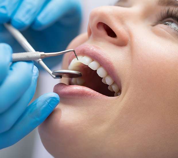 Hesperia Dental Bonding