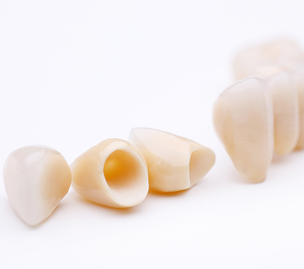 Hesperia Dental Crowns and Dental Bridges