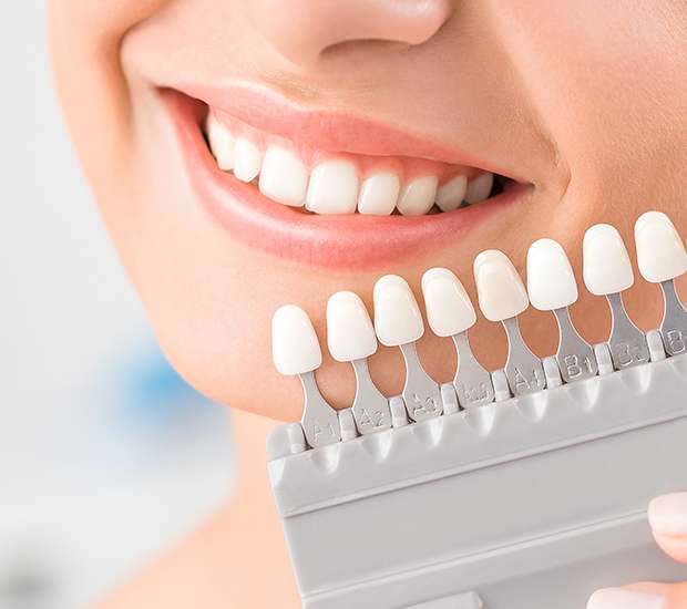 Hesperia Dental Veneers and Dental Laminates