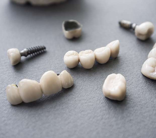 Hesperia The Difference Between Dental Implants and Mini Dental Implants
